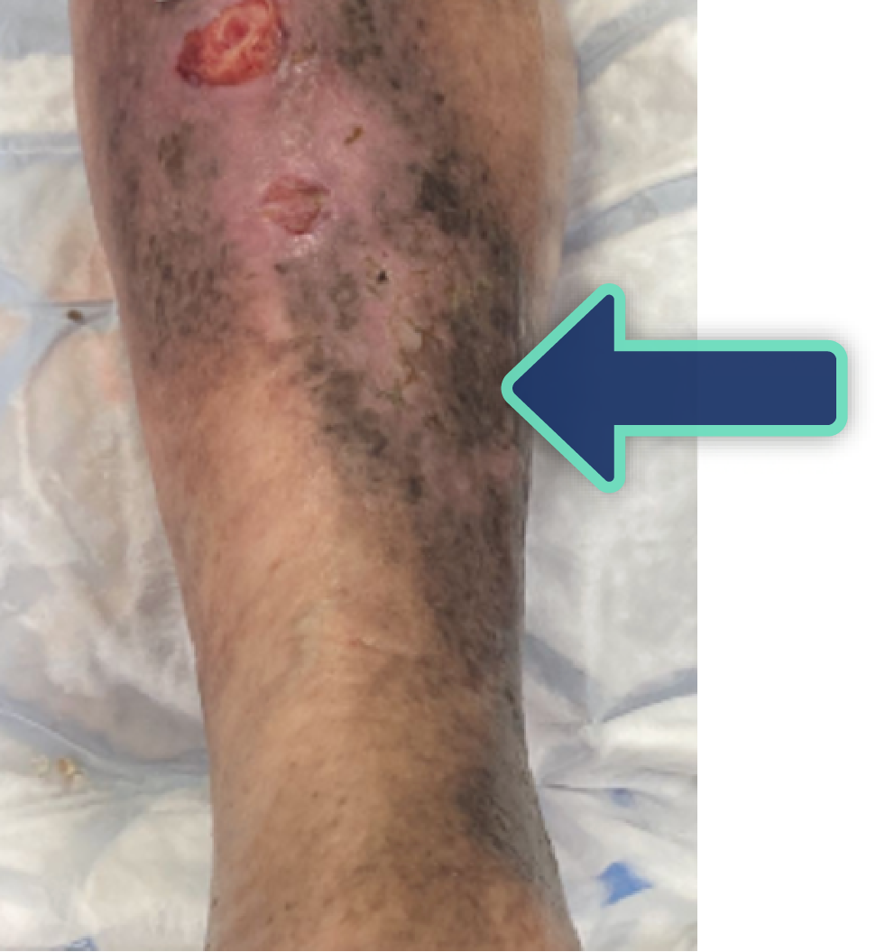 1-showing-skin-staining-0