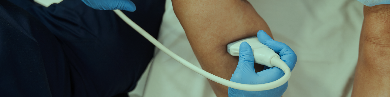 Vein scans & treatments